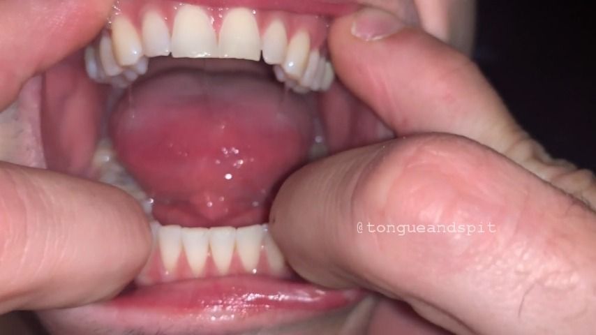 Patrick Mouth Video 1