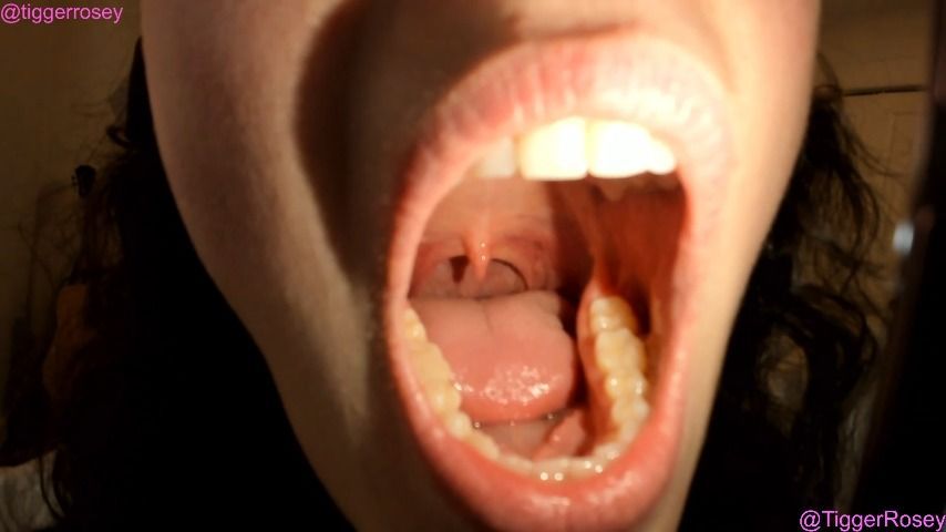 Throat Examination