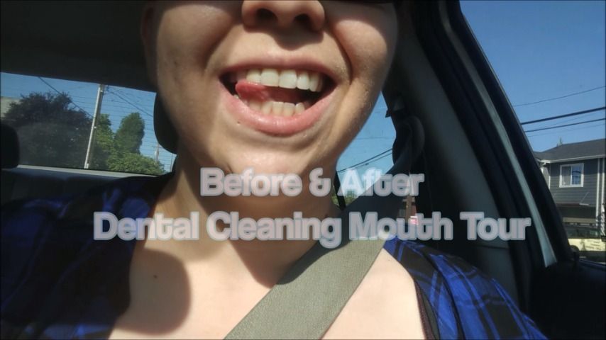 got my teeth cleaned- mouth tour