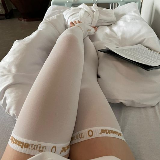 My Stockings Worn after surgery 6 days