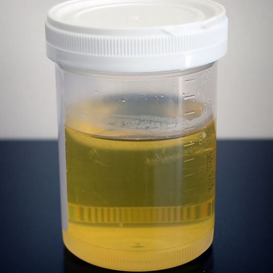 a small vial of my urine