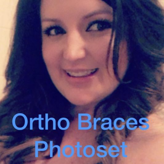 Ortho Braces Photoset