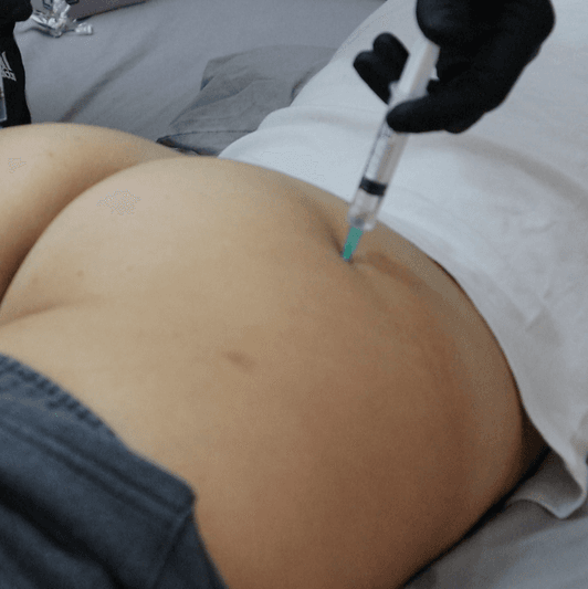 12 vids of but injections