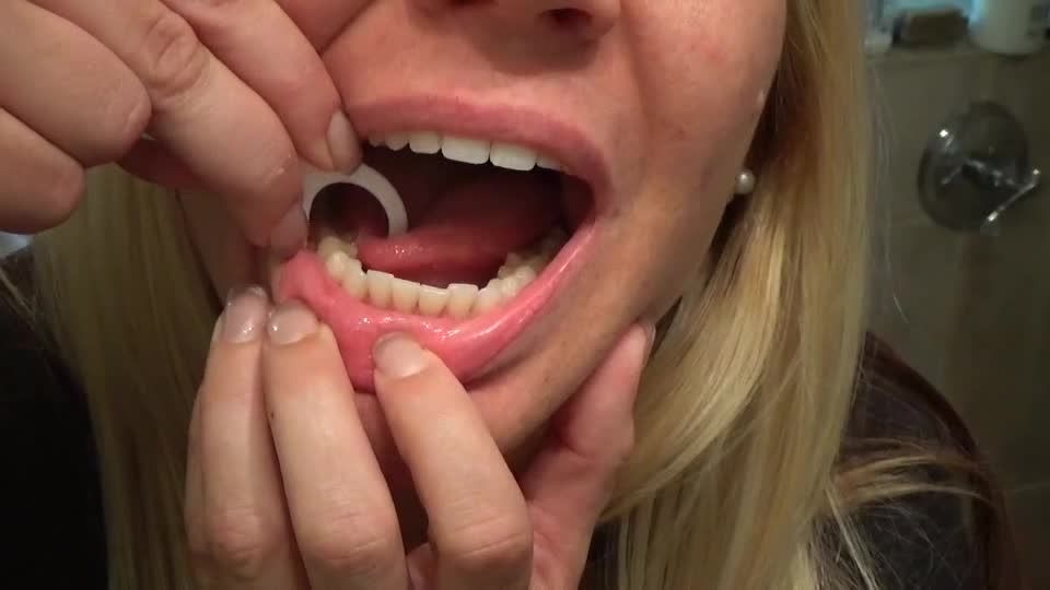 Teeth Cleaning - Angel Lee