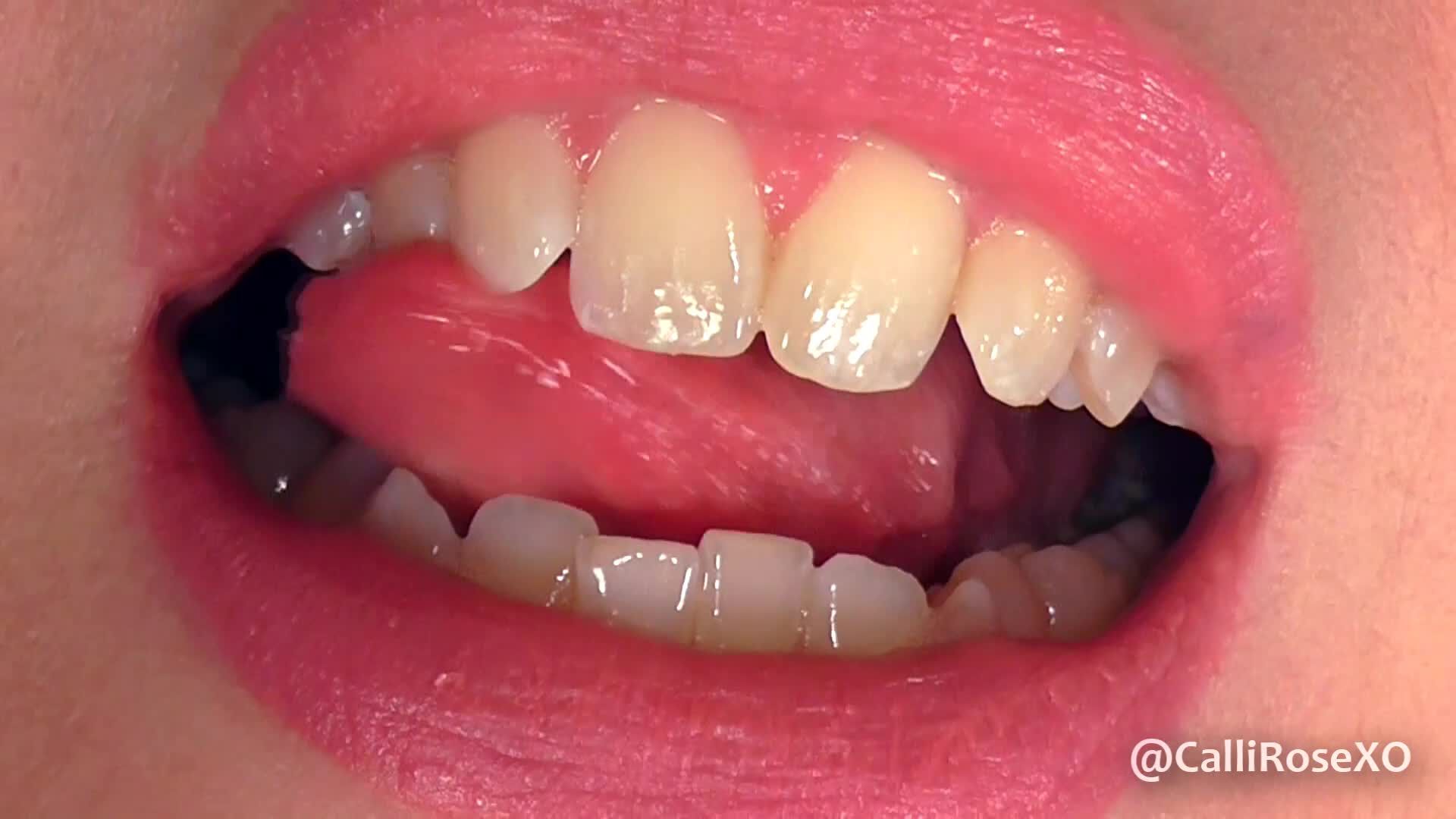 My Vampire Teeth