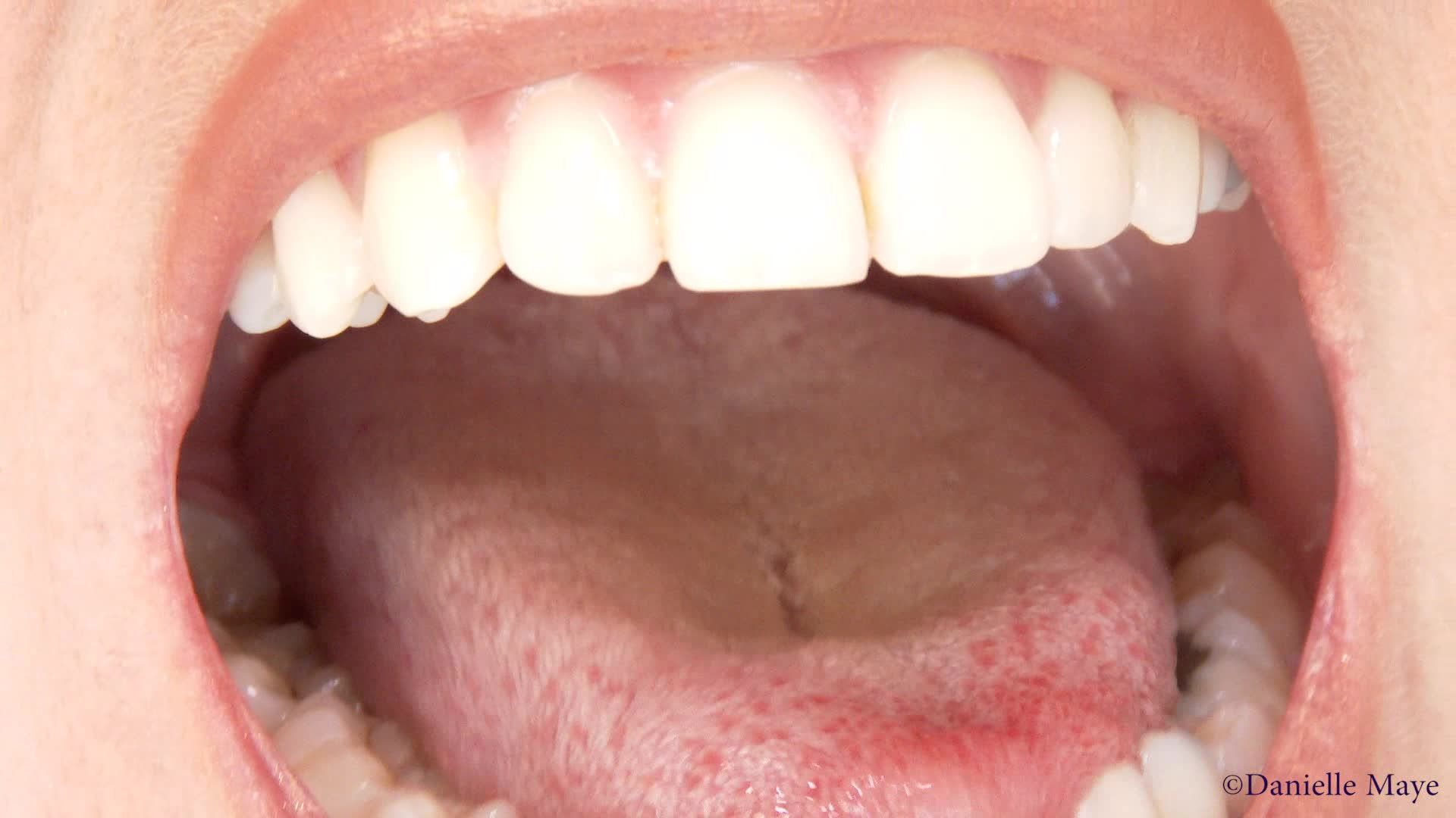 Exploring Danis Mouth Tongue  Throat