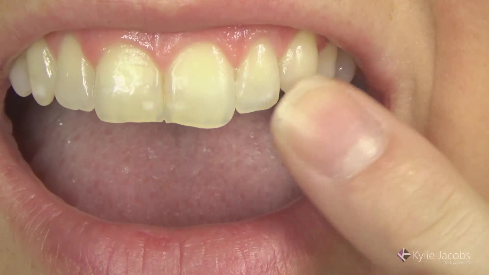 Mouth Exploration After Dental Visit