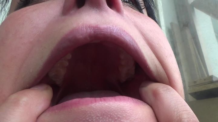 Kate open her mouth wide