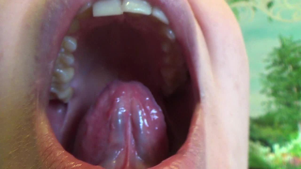Mouth , throat, teeth , tongue and uvula