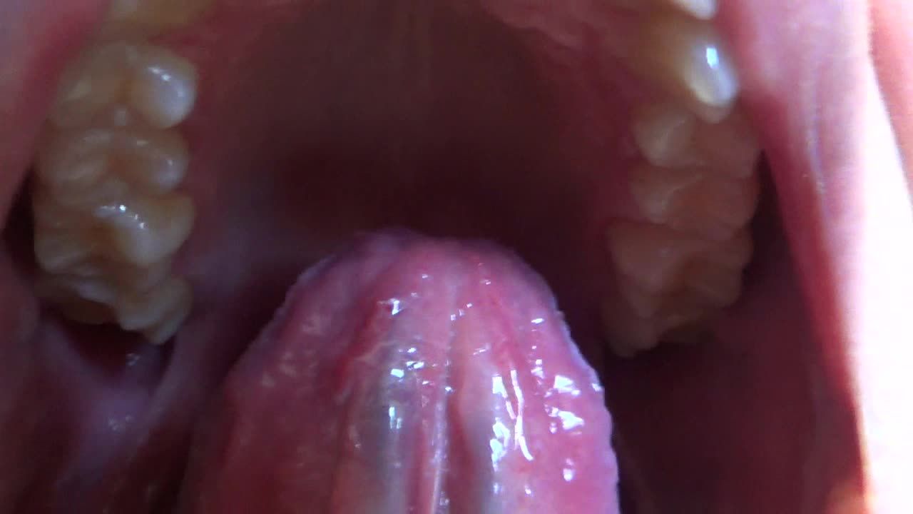 Mouth , throat, teeth , tongue and uvula