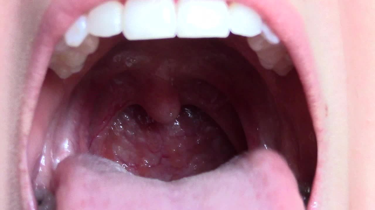 Explore my mouth and throat
