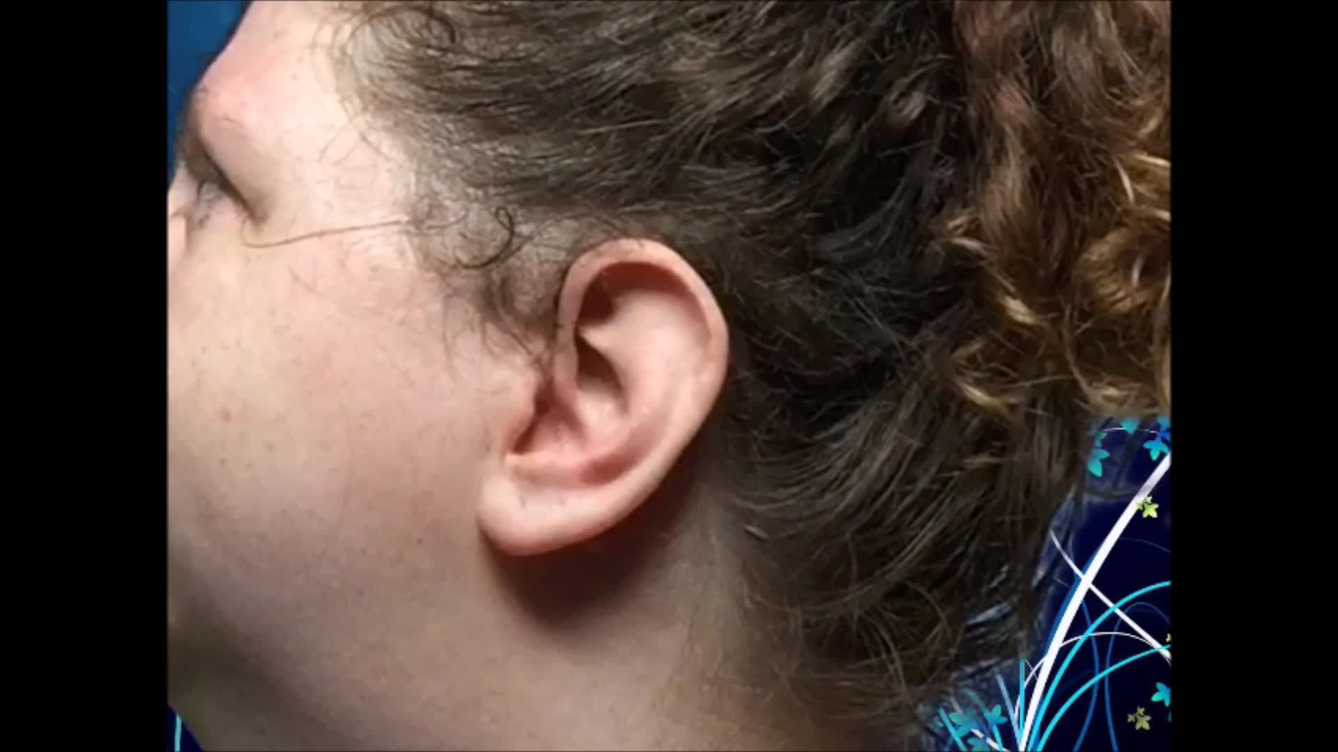 Ear Fetish Hearing Aids Close Up BBW