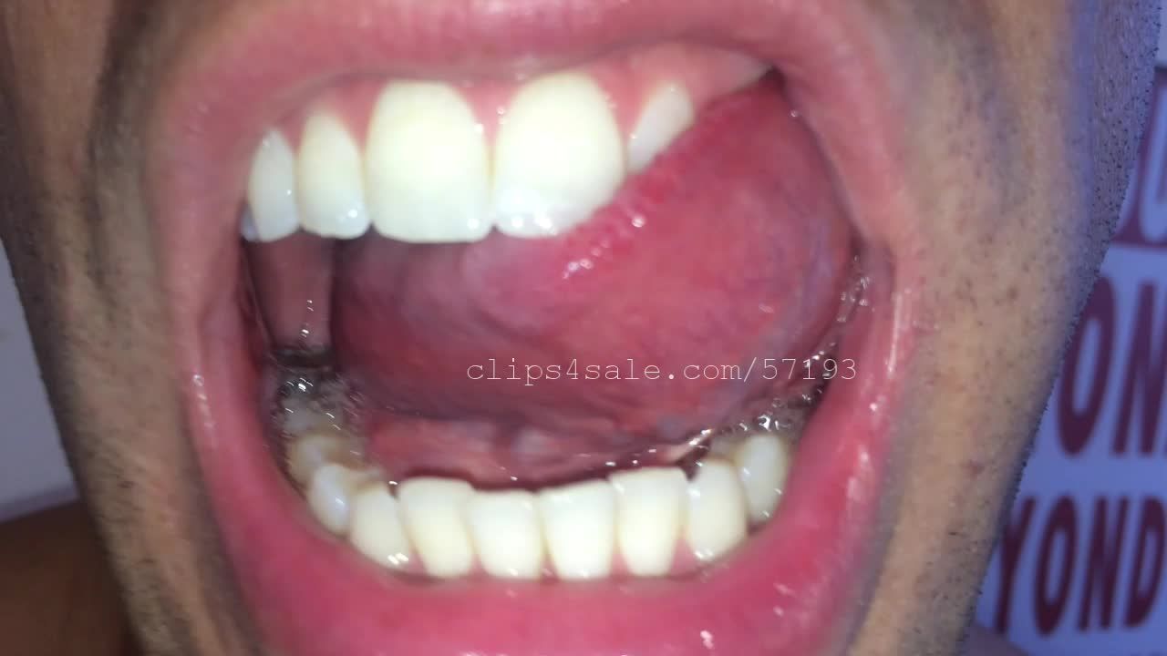 Lance Gold Mouth Video 1