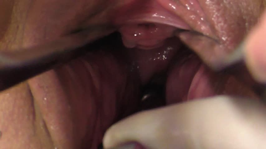 close up cervix play huge speculum