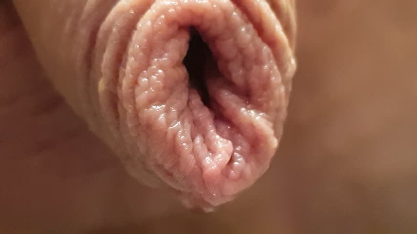 Close-up of my foreskin with piss 01