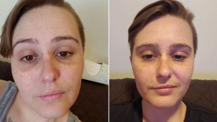 1 Month on T Update