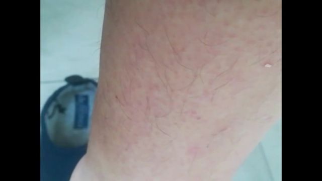 Legs not shaved for 2 months