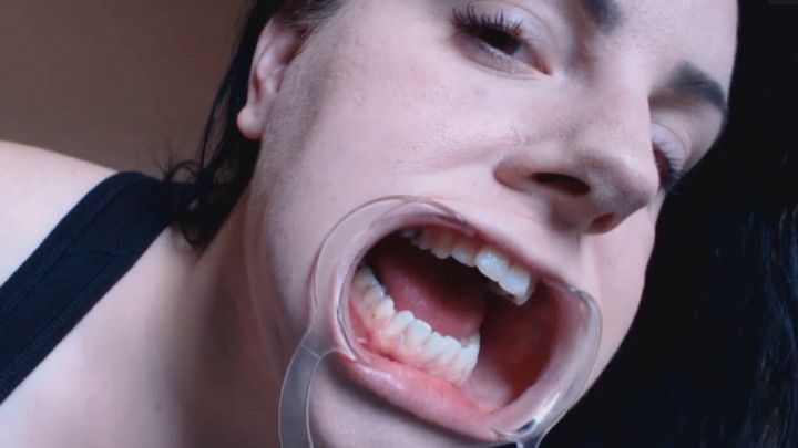 Woman's Cheek Retractor Opens Mouth Wide