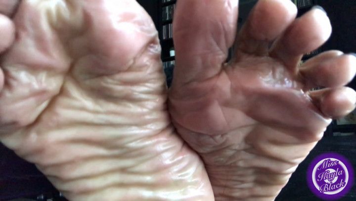Sweaty Wrinkled Soles &amp; Toes