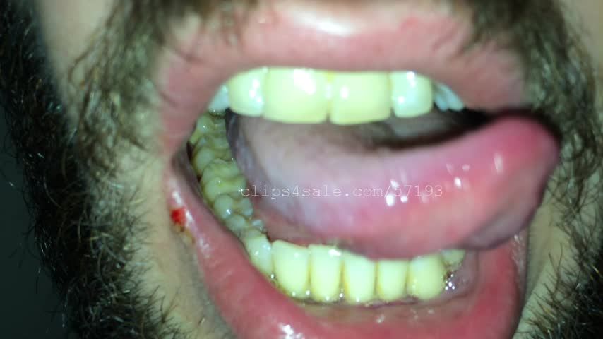 Jesse Prather Teeth and Tongue Video 1
