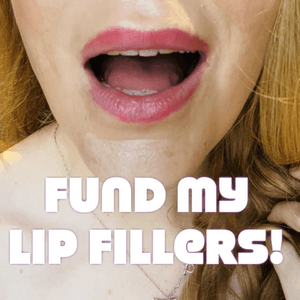 Fund My Lip Fillers!