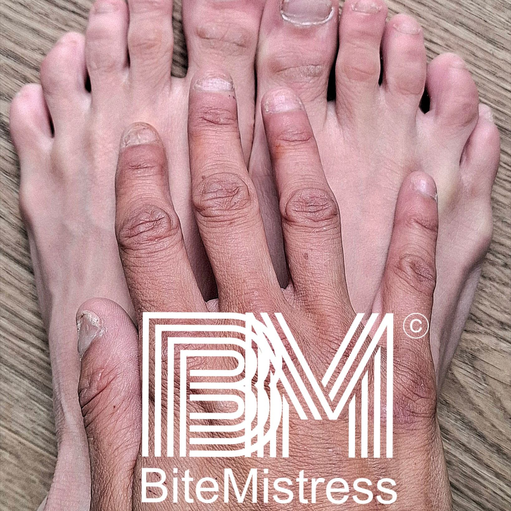 Nail Biting Raw and Bare Hand and Foot Nails
