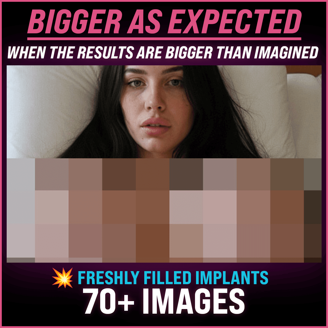 BIGGER THAN EXPECTED  IMPLANT OVERLOAD