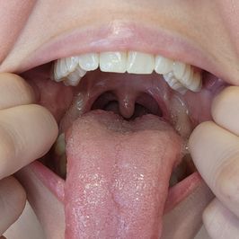 Pics Mouth Fetish