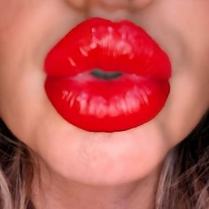 Lip Filler