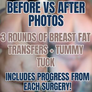 Surgery Progress