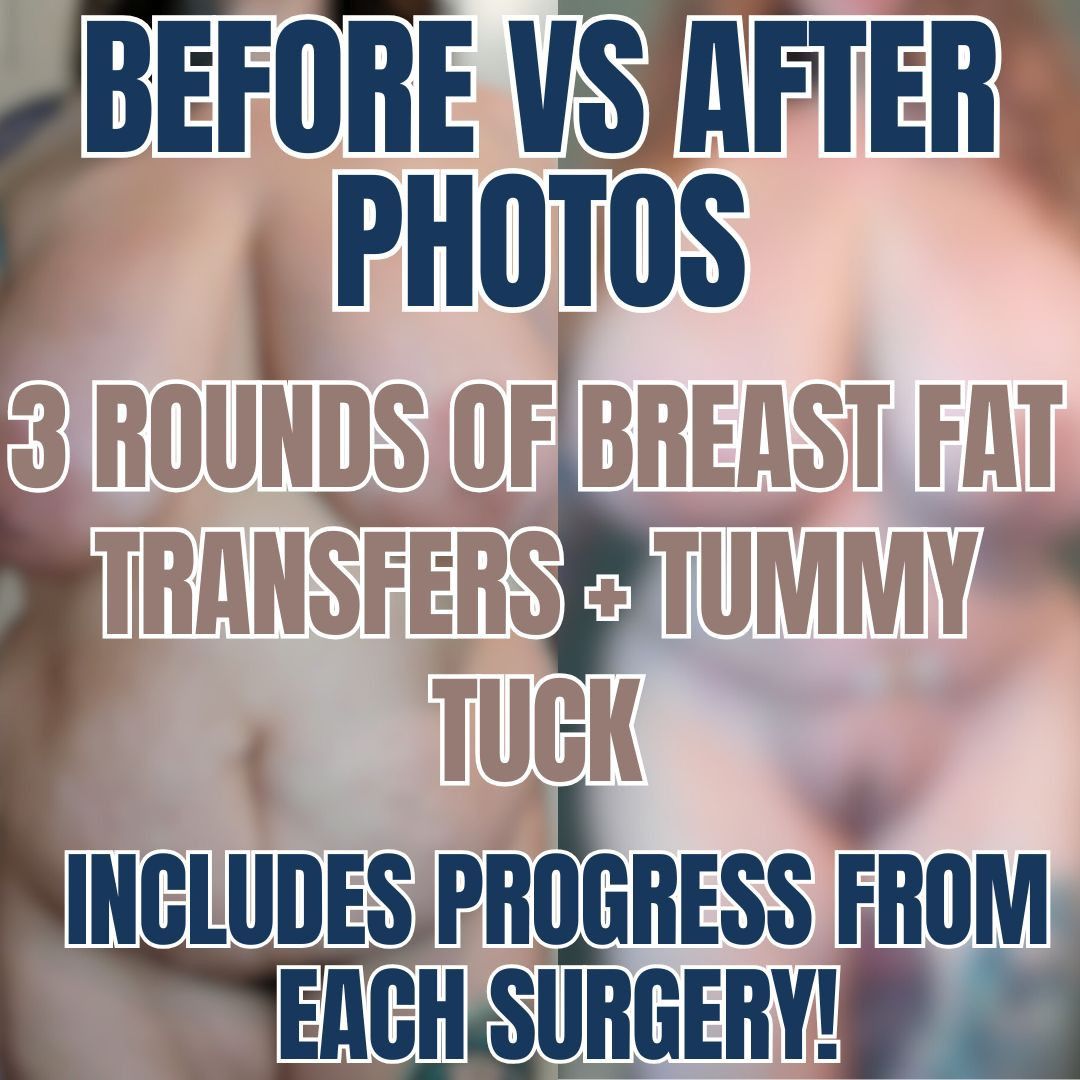 Surgery Progress