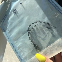 My Braces !