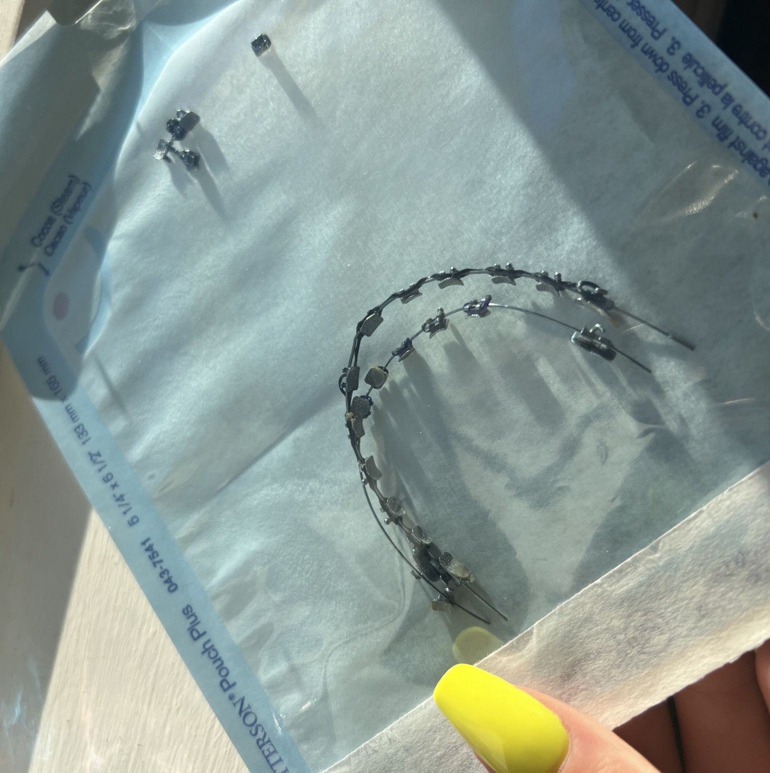 My Braces !