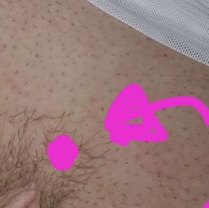 Pussy Piercing