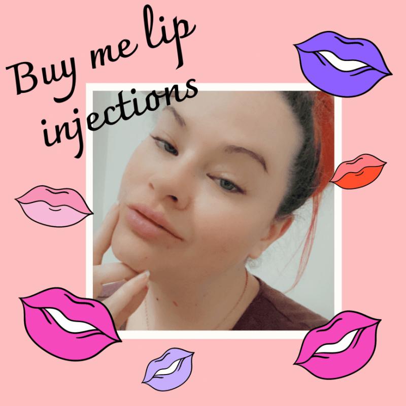 Buy Me Lip Injections