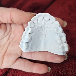 My Mouth