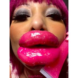 38 Pics From 8 12 25 2nd Day Lip Swelling