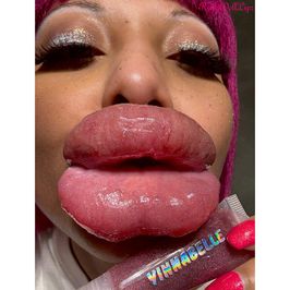 38 Pics From 10 7 25 2nd Day Lip Swelling