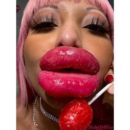 38 Pics: Blow Pop 2 Freshly Injected Lips