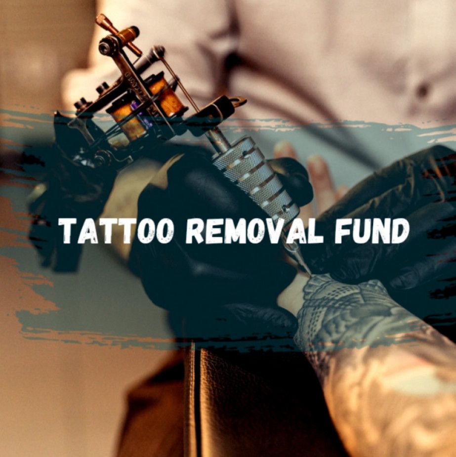 Help me remove unwanted tattoos