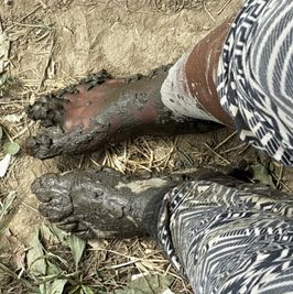 Muddy Feet