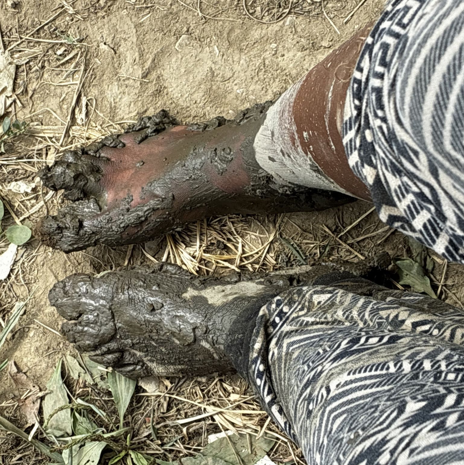 Muddy Feet