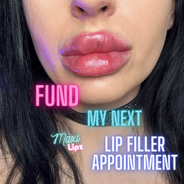 Fund my next LIP FILLER appointment