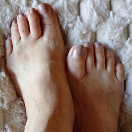 Feetpics