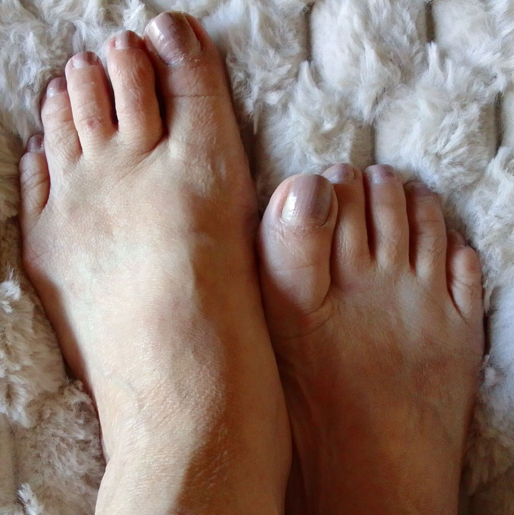Feetpics