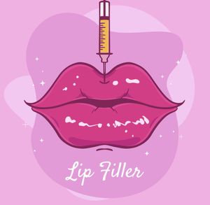 Lip filler lip injections