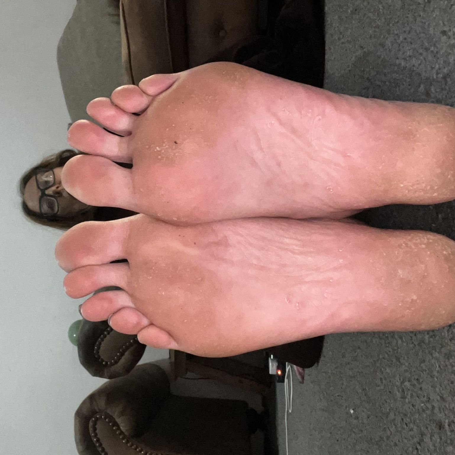 Thebarefootarchitect dry crusty feet pictures