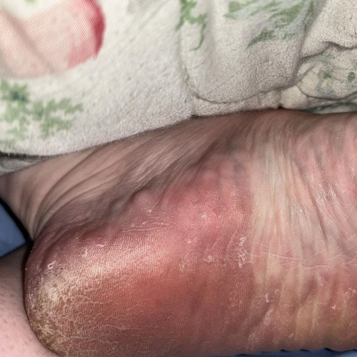 Goddess 2444 crusty feet and heels pictures