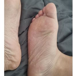 Mamilatina13 dry feet plus tan nylon sole pictures  13 pics