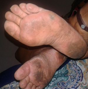 Delicious crusty soles and dirty sock pictures 2